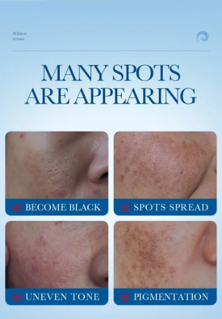 Sérum Contorno de Ojos Antiedad Blanqueante con Colágeno (15ml)